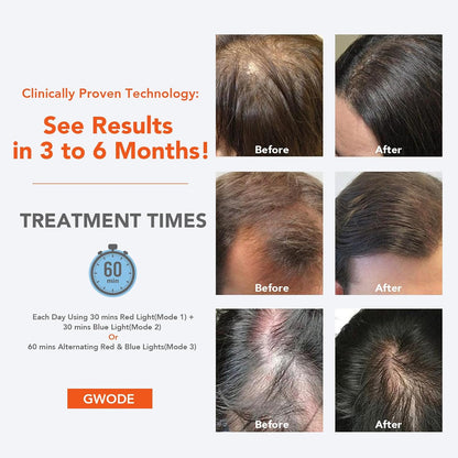 Hair Loss Thinning & Alopecia Treatment for Men & Women Wireless Rechargeable Red Light Therapy for Hair Growth - FDA Cleared Laser Cap for Hair Regrowth